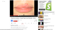 FireShot Screen Capture #100 - '▶ Pimple home treatment - Simple Pimple Home Remedies - zit home treatment - YouTube' - www_youtube_com_watch_v=kbC4PrzyUY8